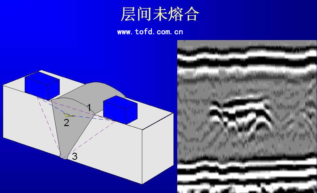 层间未熔合图谱